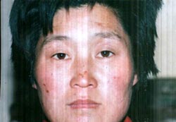 Image for article Photos : Une pratiquante de Shandong, le visage de Madame Zhao Fengying a été brûlé par les cigarettes d'un policier